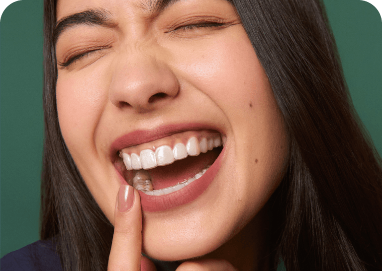 Mulher sorrindo com o aparelho invisível SouSmile