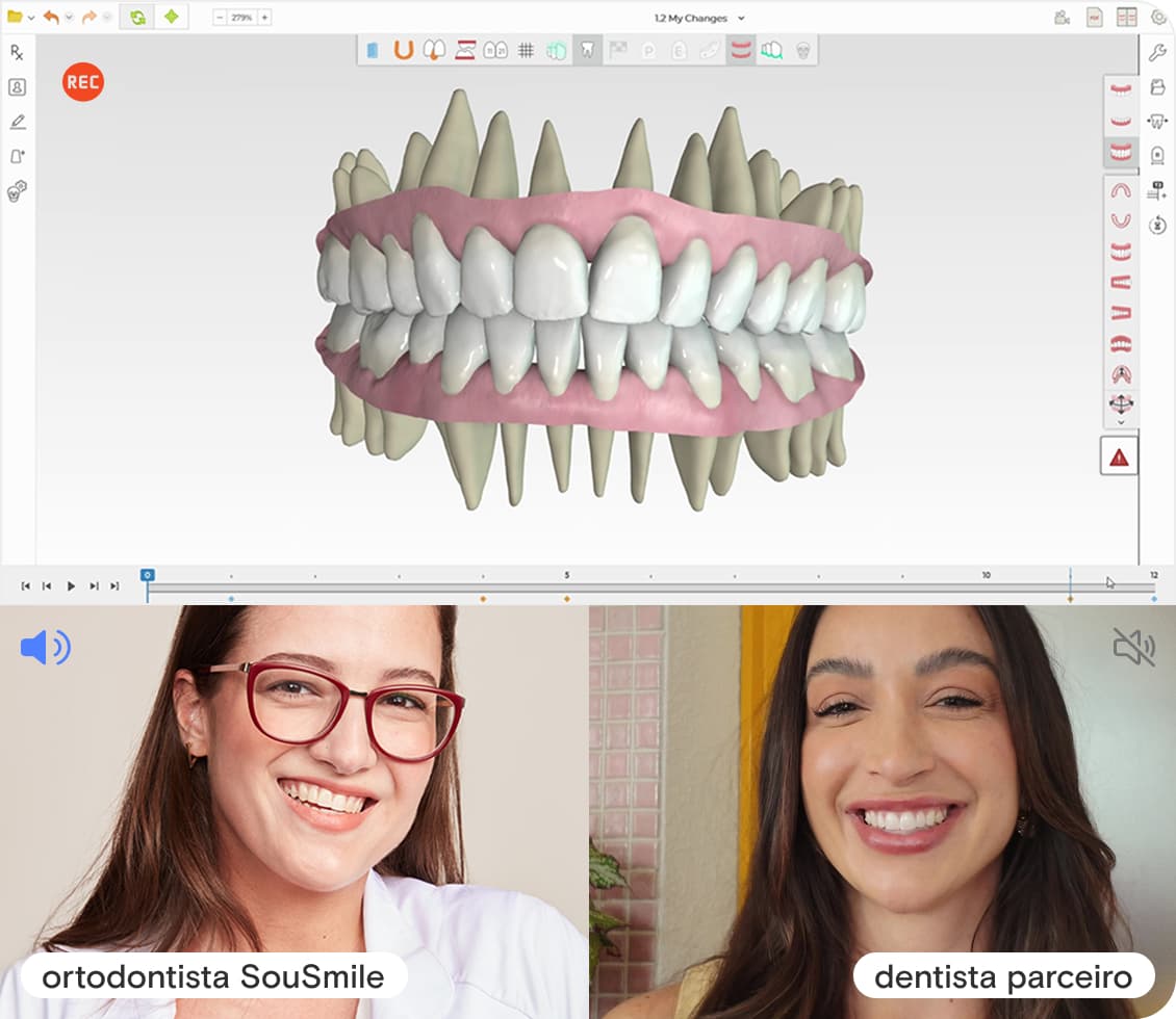 Dentistas em uma vídeo chamada planejando um caso de um paciente SouSmile