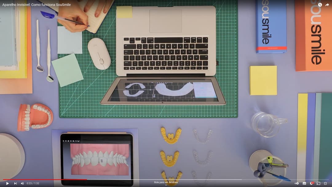 Uma pessoa manuseando o aparelho invisível SouSmile