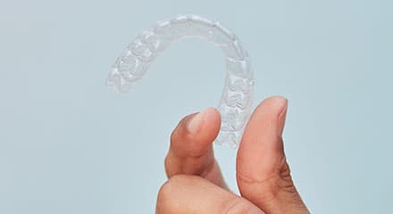 Uma mão segurando o aparelho invisível SouSmile
