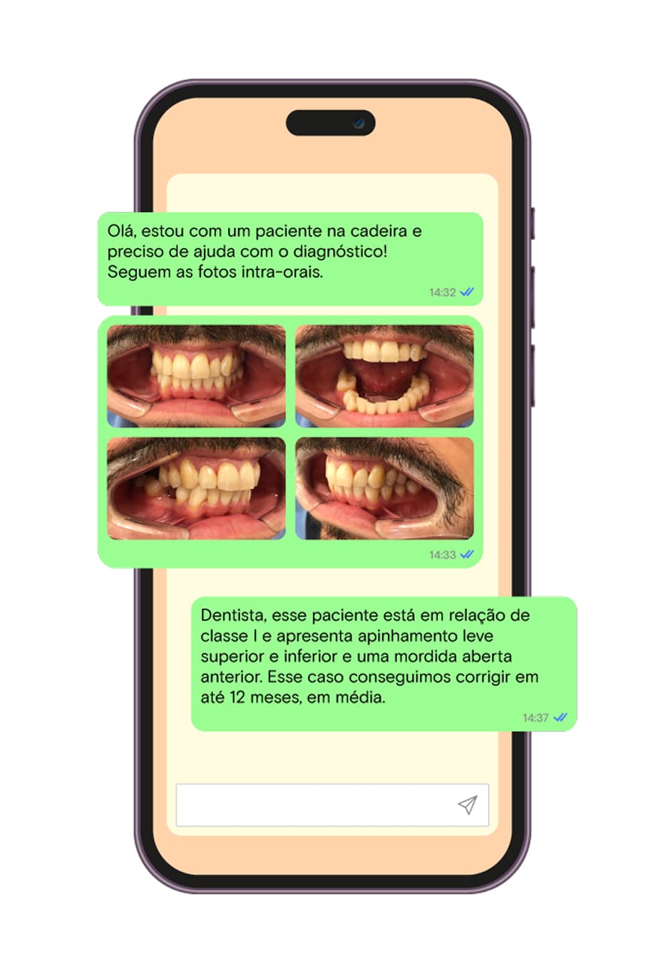 Suporte por especialistas SouSmile