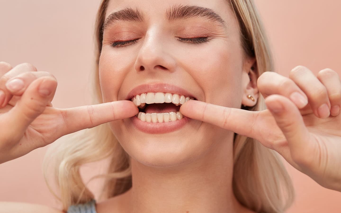 mulher sorrindo e apontando para o alinhador nos dentes