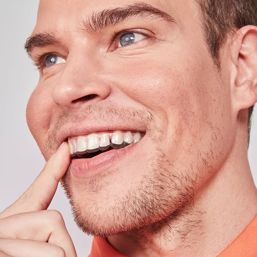 homem com aparelho invisivel representando a jornada de uso do produto