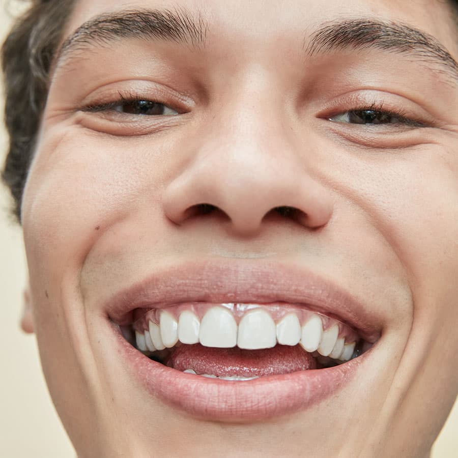 homem sorrindo com aparelho transparente
