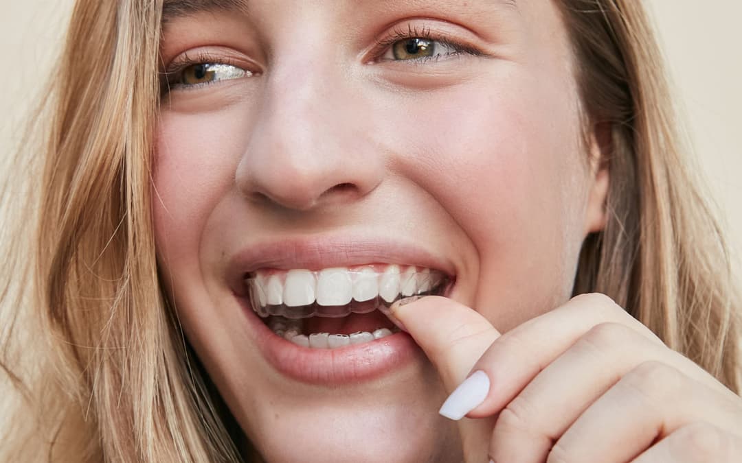 mulher sorrindo com aparelho transparente