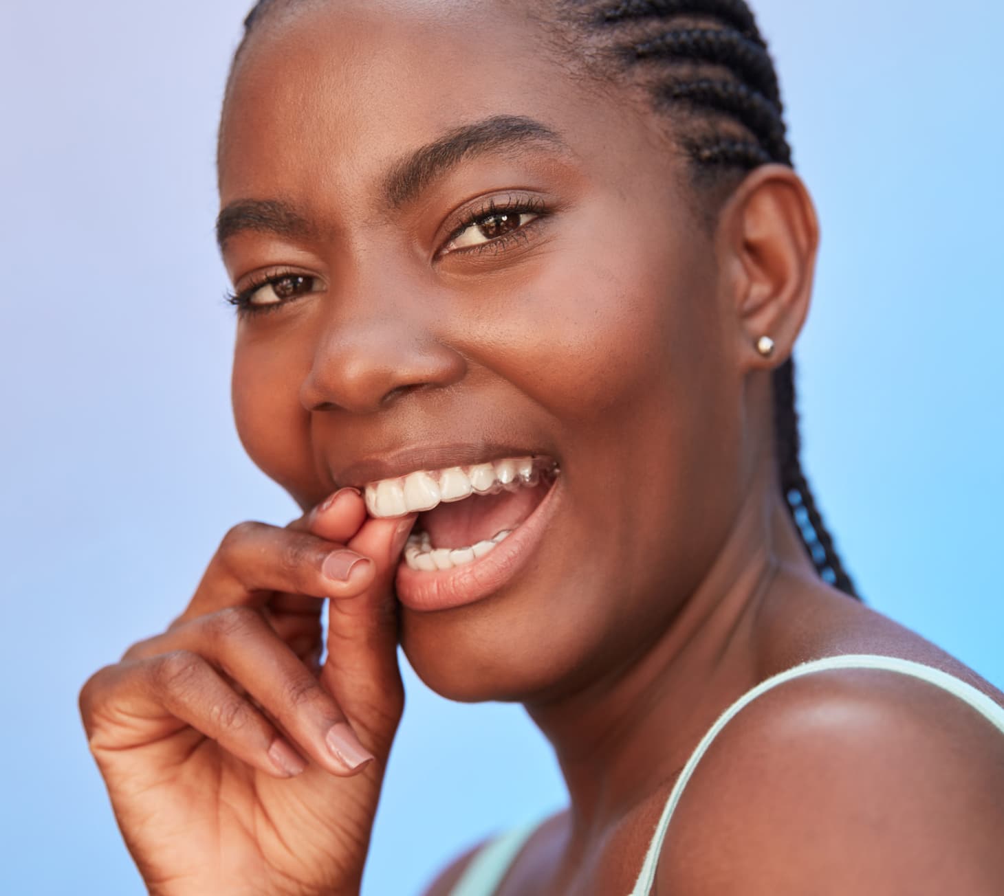 Mulher sorrindo com o aparelho transparente SouSmile