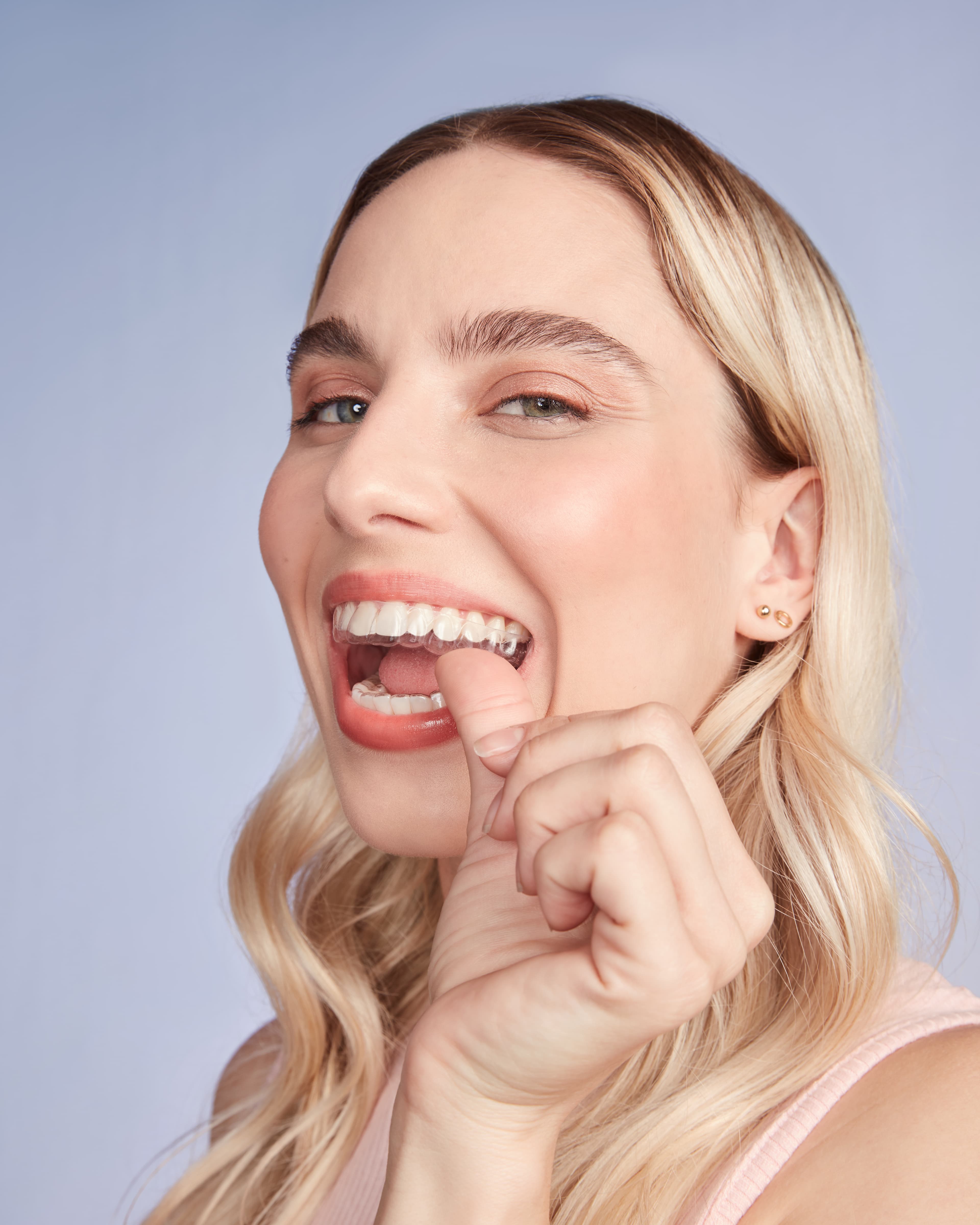SouSmile ou Invisalign quais as diferenças
