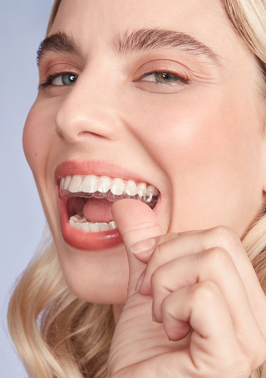 mulher sorrindo com o aparelho invisível nos dentes
