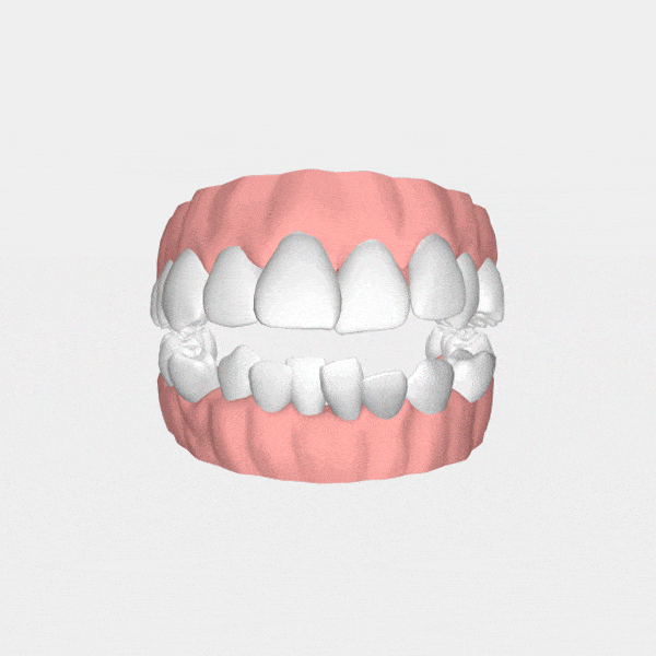 Imagem ilustrativa da arcada dentária